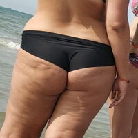 culona cellulite -MG-0713 (1).jpg
